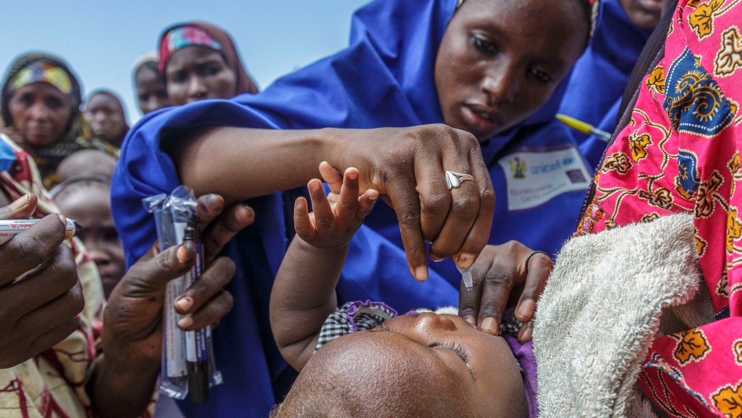 Ein Säugling bekommt eine Polio-Impfung. 