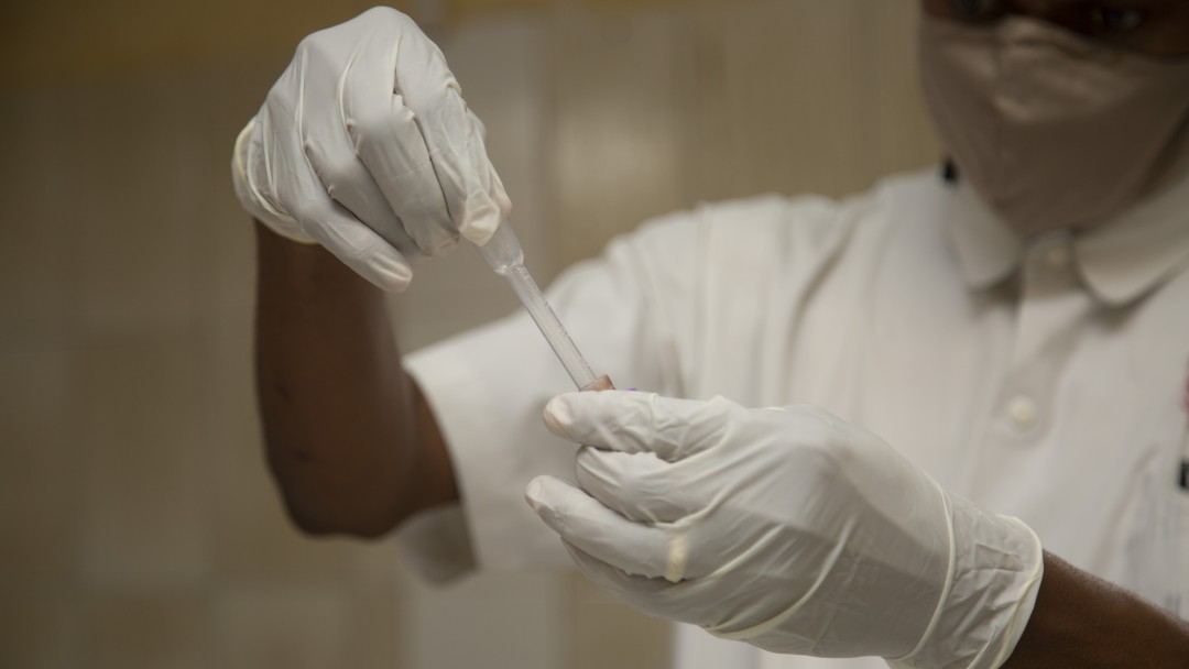 Ausschnitt eines Mannes der im Labor mit Handschuhen ein Röhrchen untersucht